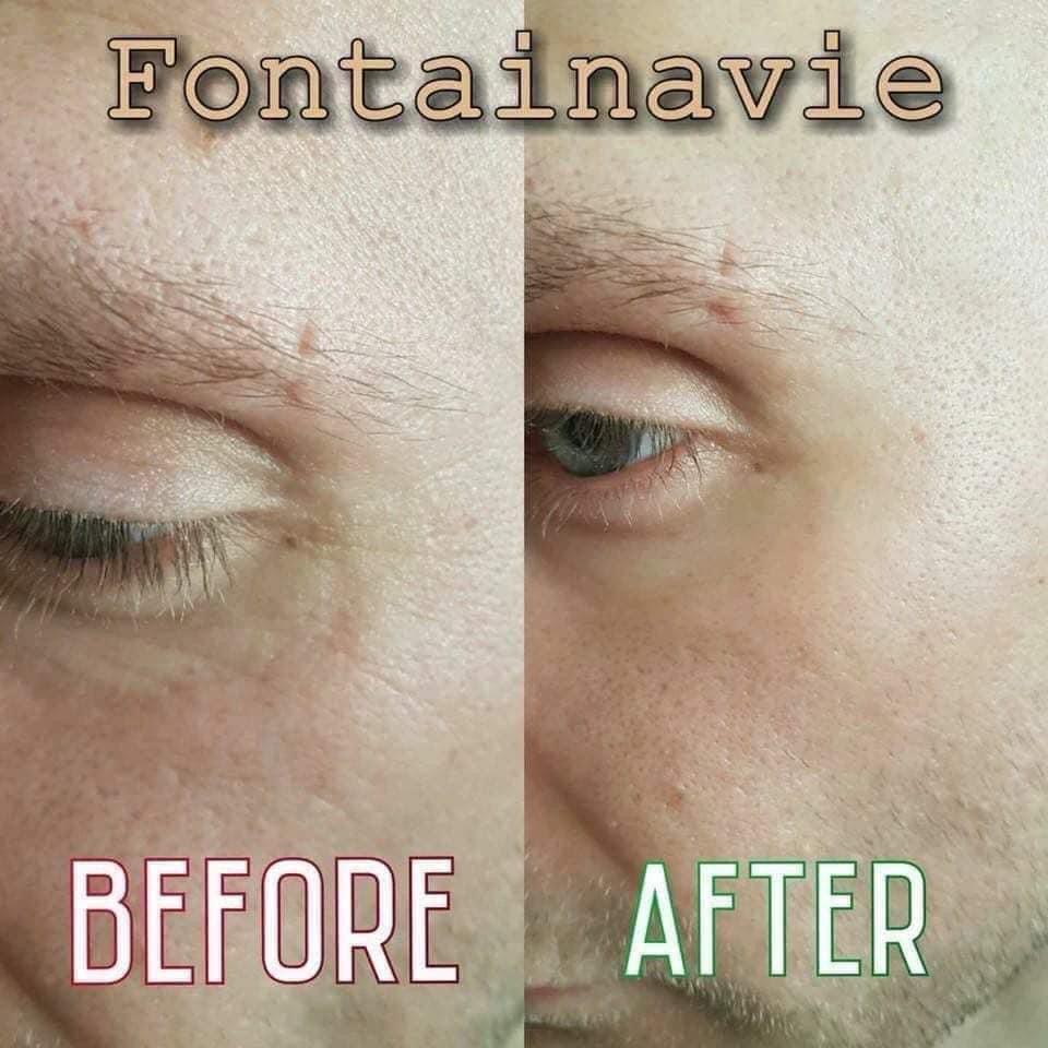 Eye Serum Eye-Brator